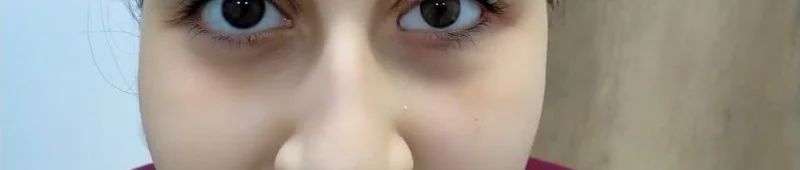 بعد